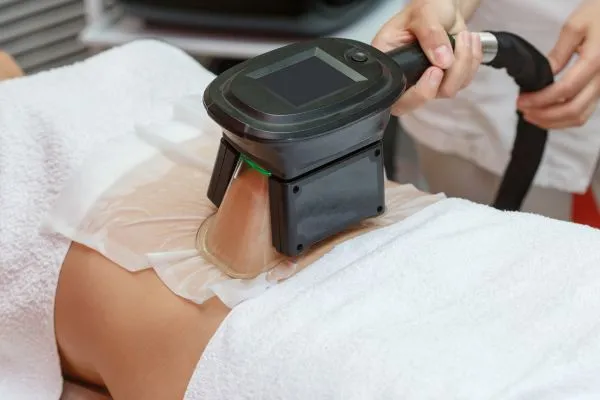 Image of person having fat freezing treatment to help weight gain Leighton Buzzard