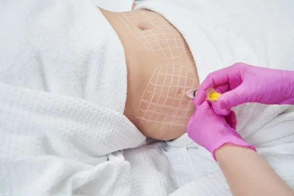 image of fat dissolving injections on love handles to help combat weight gain Leighton Buzzard