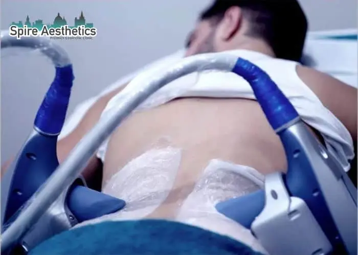 Man having fat freezing treatment done on love handles before a competitions Leighton Buzzard to create a sculpted look.