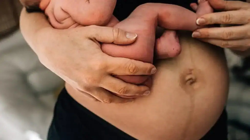 Why Is My Stomach Still Big After Pregnancy Leighton Buzzard?